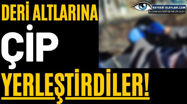 Deri Altlarına Çip Yerleştirdiler! 