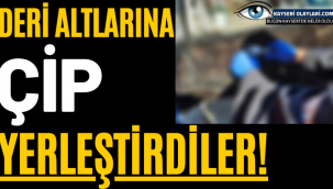 Deri Altlarına Çip Yerleştirdiler! 