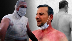 Edirne'de komşu dehşeti! Bir anda neye uğradığını şaşırdı