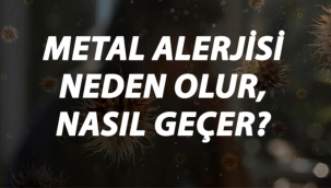 Metal Alerjisi Nedir, Neden Olur ve Nasıl Geçer? Metal Alerjisi Belirtileri ve Tedavisi Hakkında Bilgi