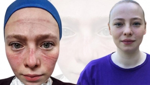 Salgınla savaşan sağlıkçıların simgesi olmuştu! Hemşire Seher Altuncu konuştu...