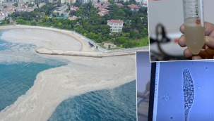 Son dakika haberler: Sebebi ortaya çıktı.. Müsilaj kâbusunun ilk test sonuçları belli oldu! Deniz salyasının nedeni tek hücreli canlı...
