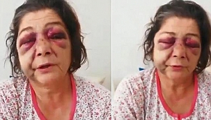 'Bakımsız park' tartışmasında oğlu ve gelini ile birlikte darbedildi