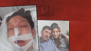 'Hoşuma gitti' dedi mide bulandıran detayları tek tek anlattı