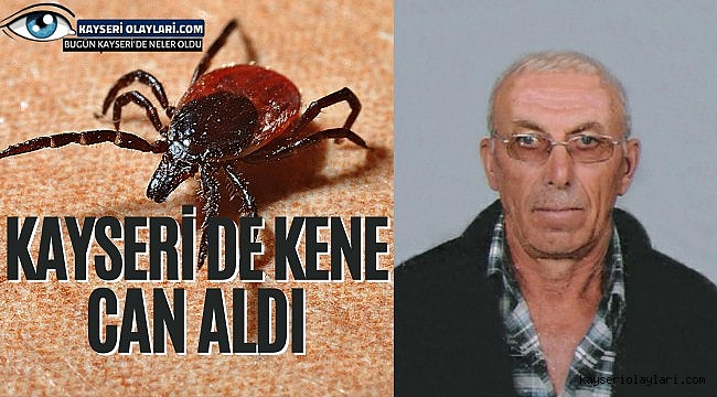 Kayseri'de Kene Yine Can Aldı!