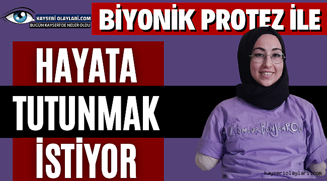 Biyonik Protez İle Hayata Tutunmak İstiyor 