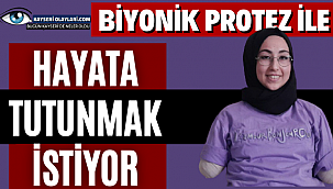 Biyonik Protez İle Hayata Tutunmak İstiyor 