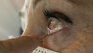 Covid-19'in etkilediği bir organ daha! Gözümüzü nasıl koruyabiliriz?