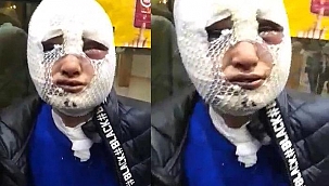 Cinsel saldırıda bulunup başından aşağı kızgın yağ döktü! Hatay'daki eski sözlü dehşetinde yeni gelişme