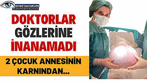 Doktorlar Gözlerine İnanamadı