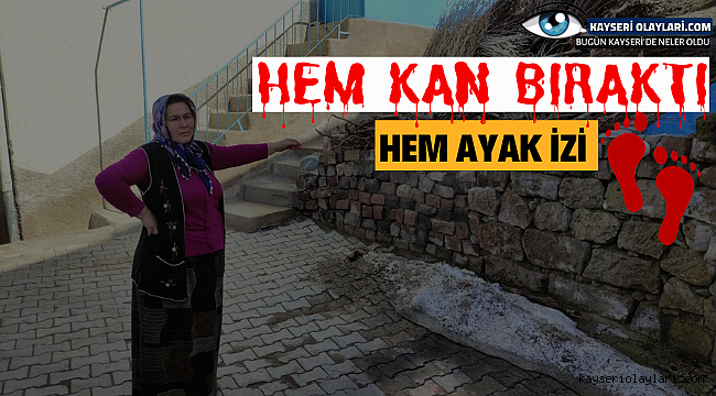 Hem Kan Bıraktı Hem Ayak İzi Kaldı