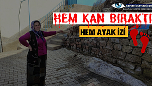Hem Kan Bıraktı Hem Ayak İzi Kaldı