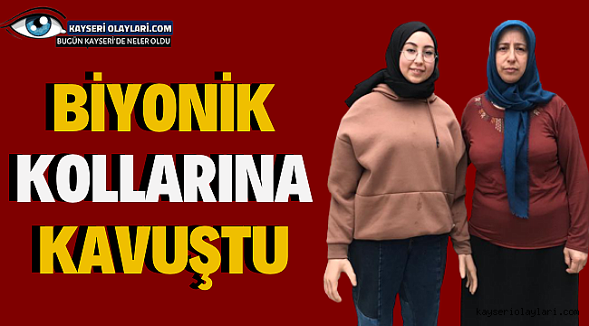  Sevim Nur, biyonik kollarına kavuştu