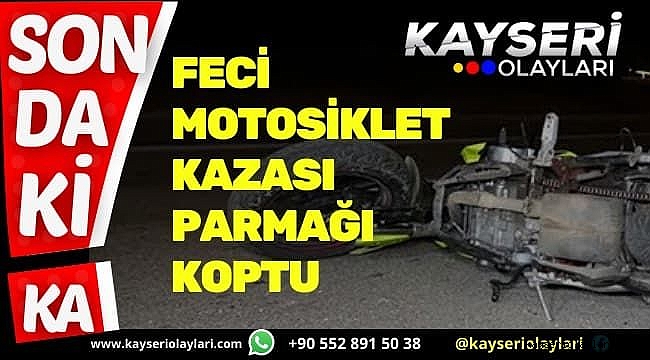 Feci Motosiklet Kazası Parmağı Koptu