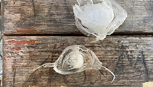 Ağzında uyuşturucu saklayan şüpheli yakalandı