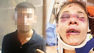 Elin kırılsın! Havva'yı 51 yerinden bıçakladı