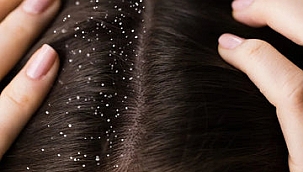 Mucizevi bir şey! Uygulayanlar, dua edecek 