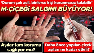 M-Çiçeği salgını büyüyor! Aşılar tam koruma sağlıyor mu? Önceki çiçek aşıları virüse karşı ne kadar etkili? 'Durum çok acil, binlerce kişi korunmasız kalabilir'